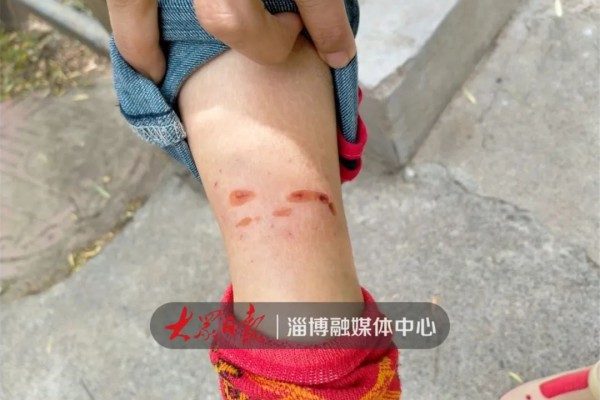 淄博一女子遛弯被咬伤!索赔难…